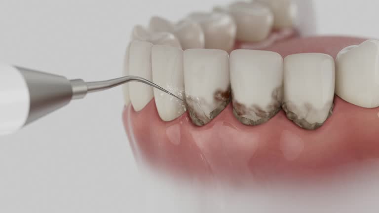 Reliable Dental Implants contractor in Cedar City, UT by Smile Center Dentistry